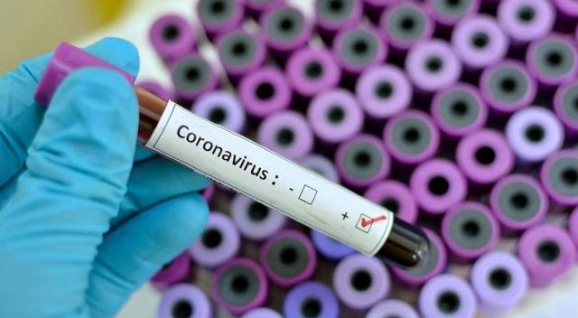 Covid 19- कोरोना के संक्रमण से बचा सकती है वैक्सीन की बूस्टर डोज